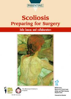 Scoliosis 
